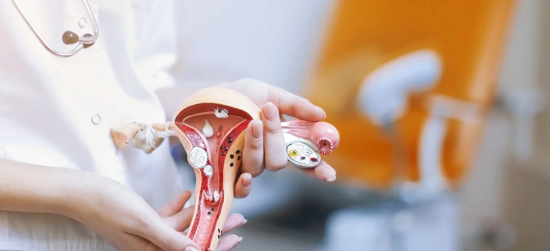 The use of ionized water in the treatment of thrush in women