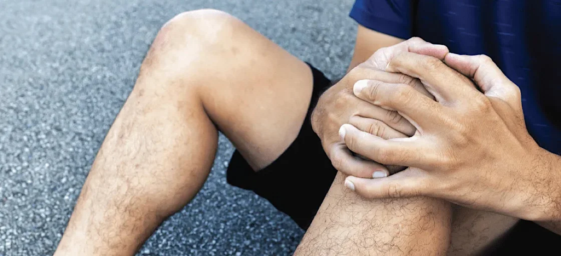 Bruises: methods of prevention and treatment 1 Bruises: methods of prevention and treatment